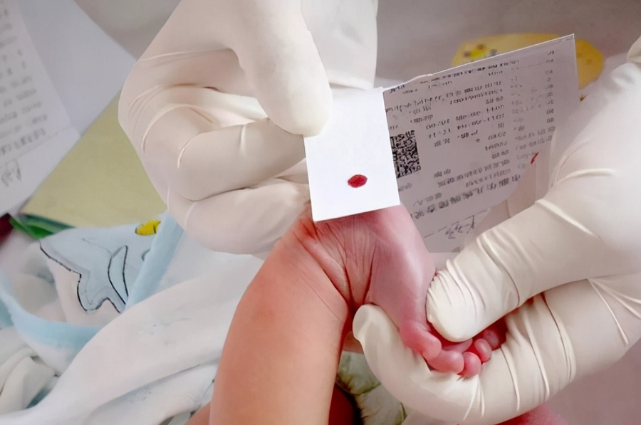 德州医院办理亲子鉴定需要生物样本有什么,德州医院办理血缘检测出结果时间